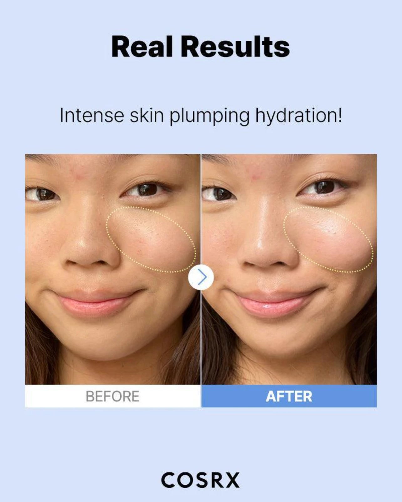 The Hyaluronic Acid 3%
