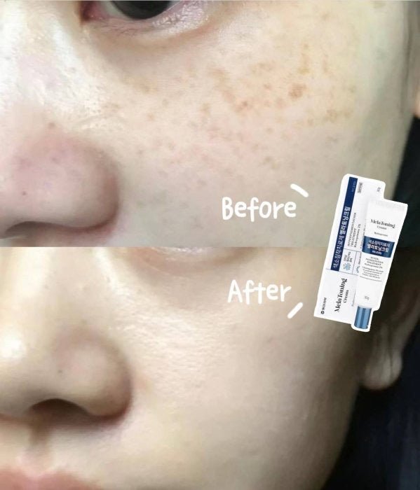 Melatoning cream 30g
