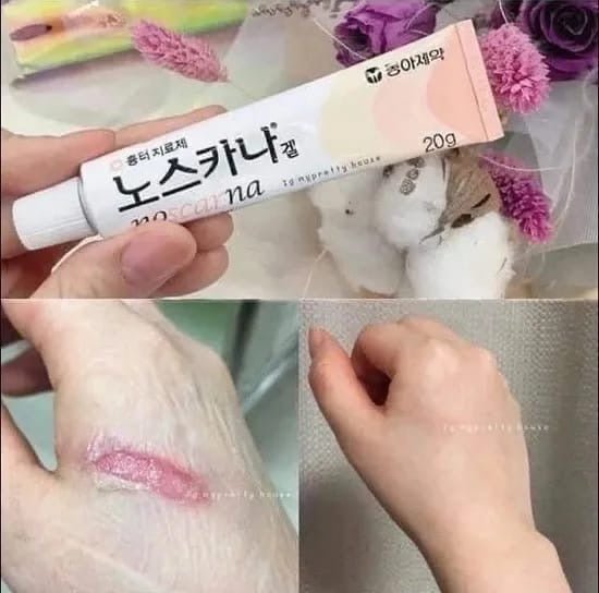 NOSCARNA Scar Gel Treat Keloid, Surgery & Acne Scars 20g
