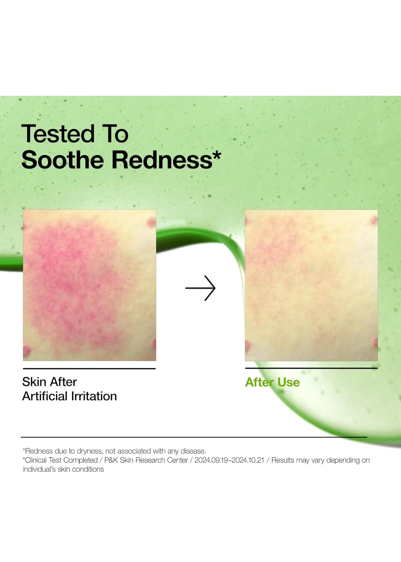 ANUA
AZELAIC HYALURON SOOTHING SERUM 30ML