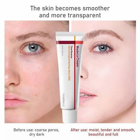 Madeca Cream
Time Reverse