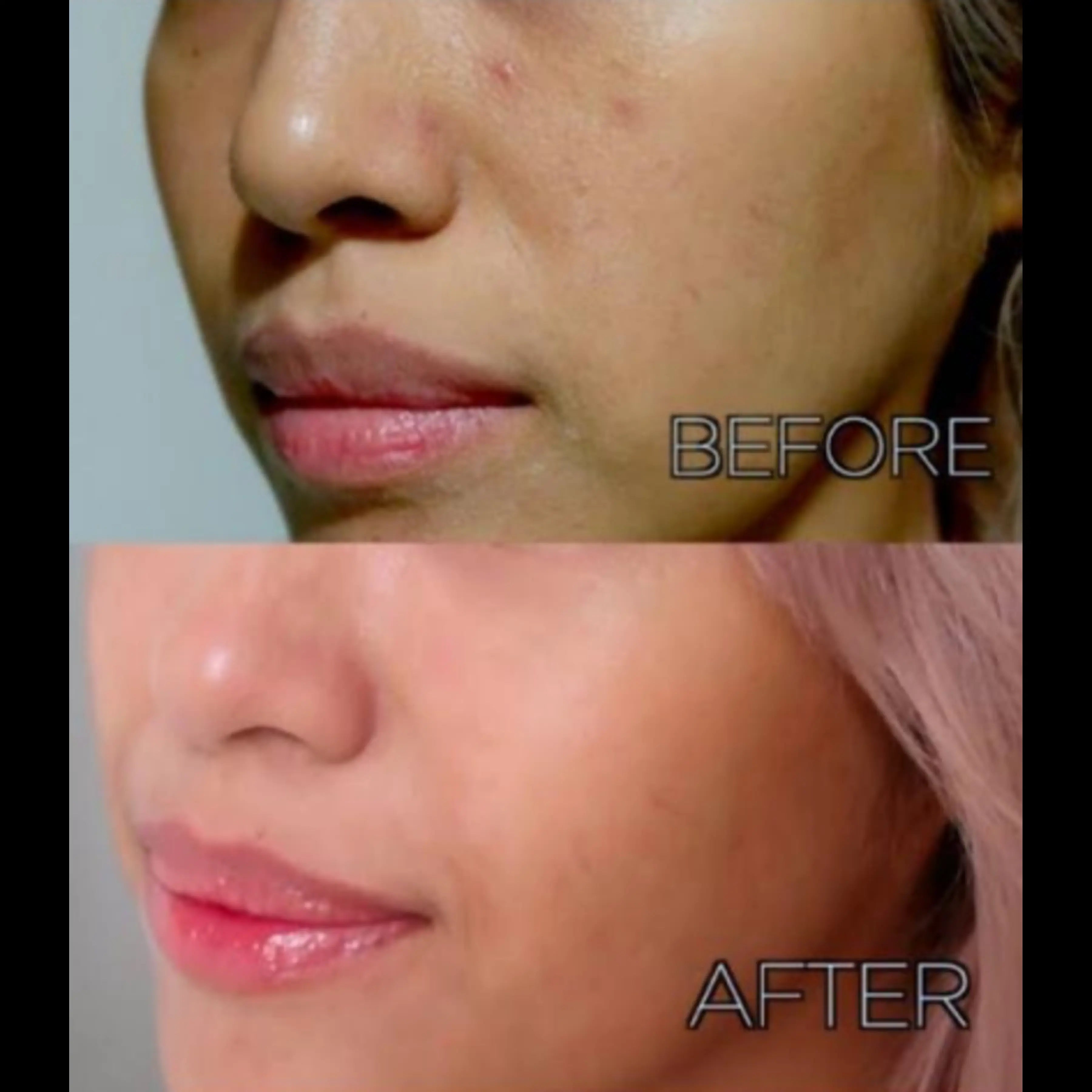 1004 Madagascar Centella Hyalu-Cica Blue serum 5 Hyaluronic Acid