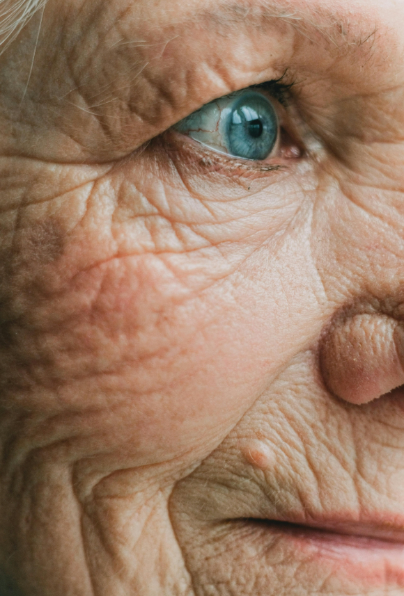 WRINKLES / SAGGING / LIFTING / ELASTICITY