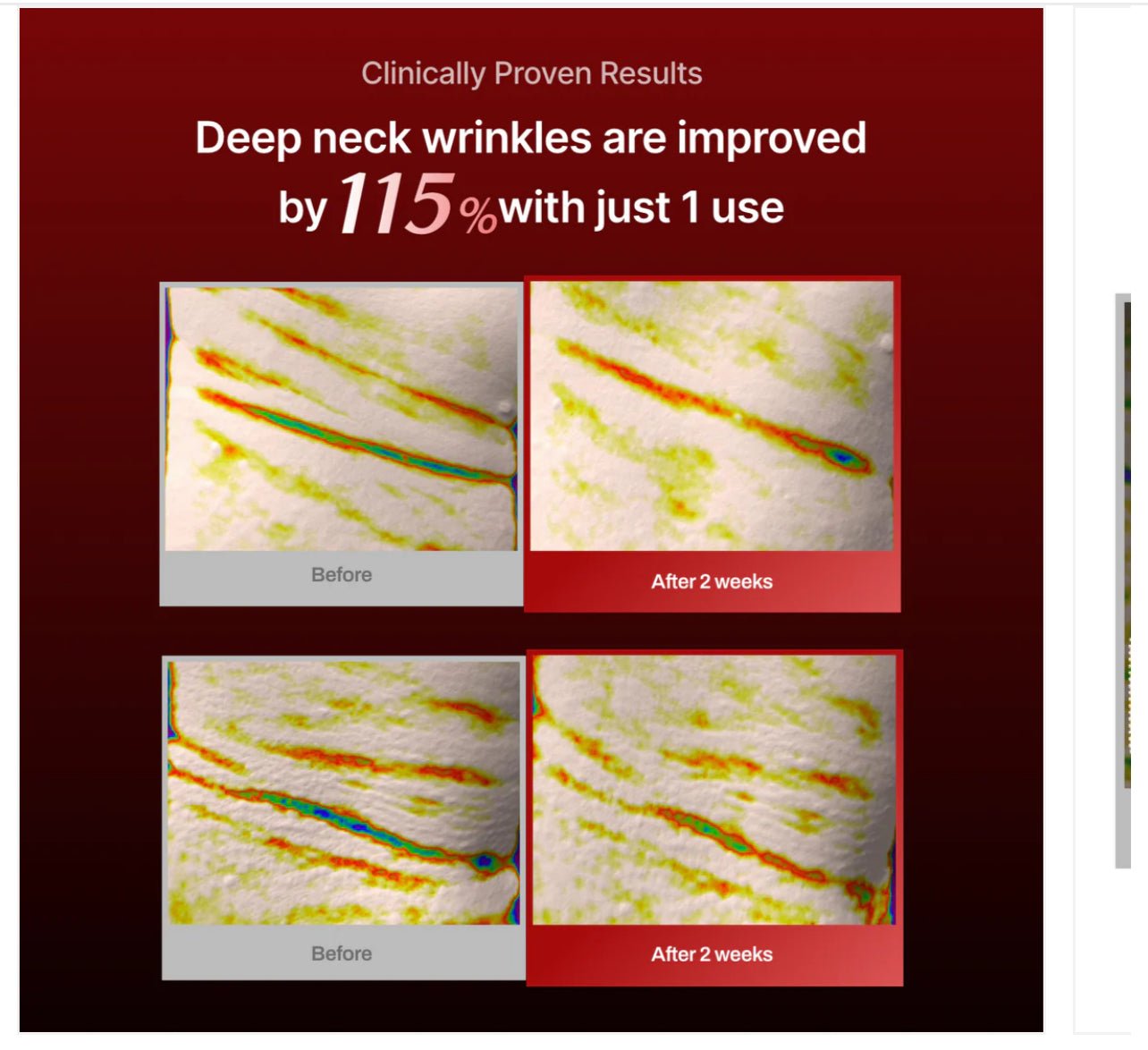 Meditherapy Wrinkle Neck mask