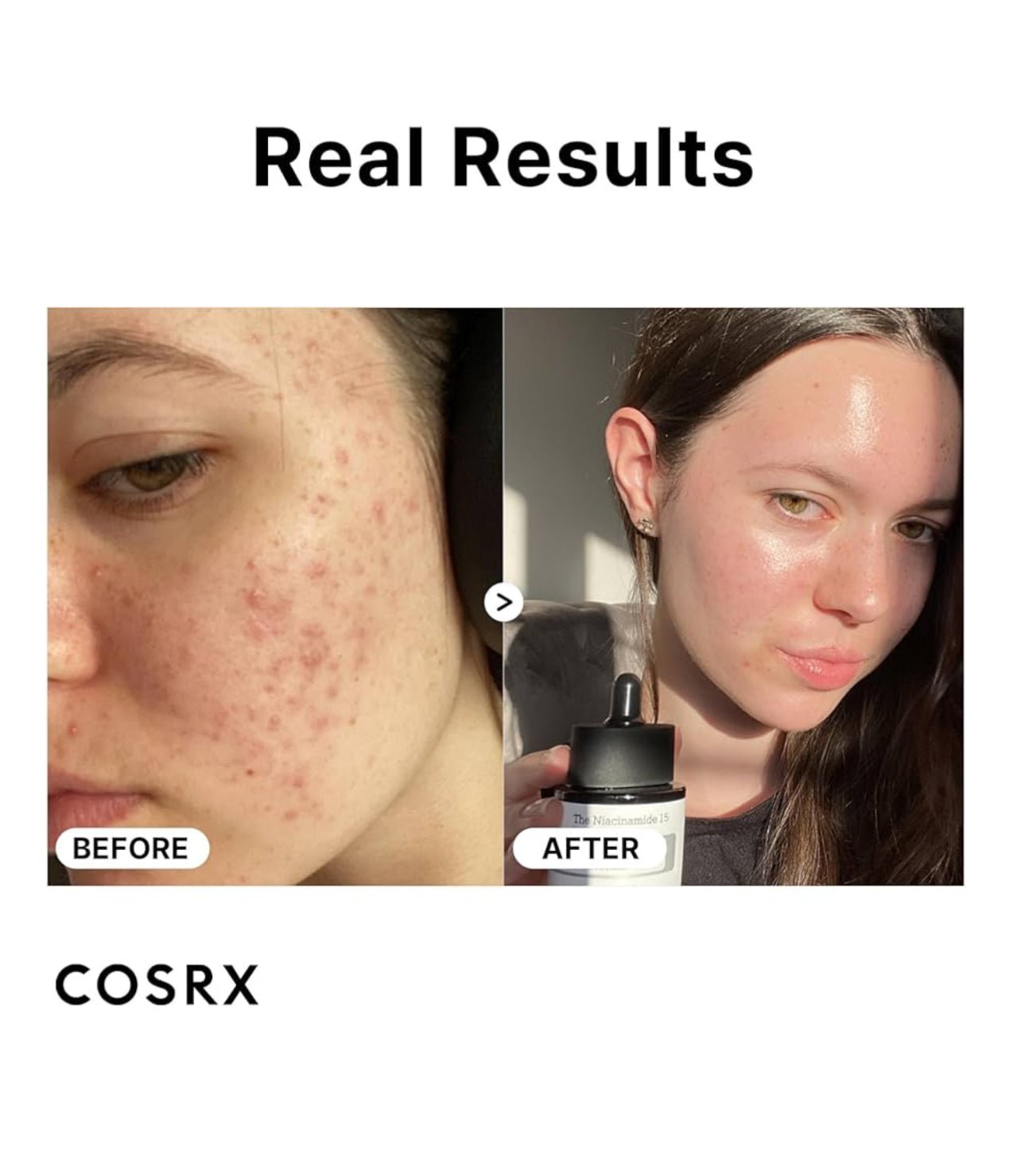 COSRX NIACINAMIDE 15%