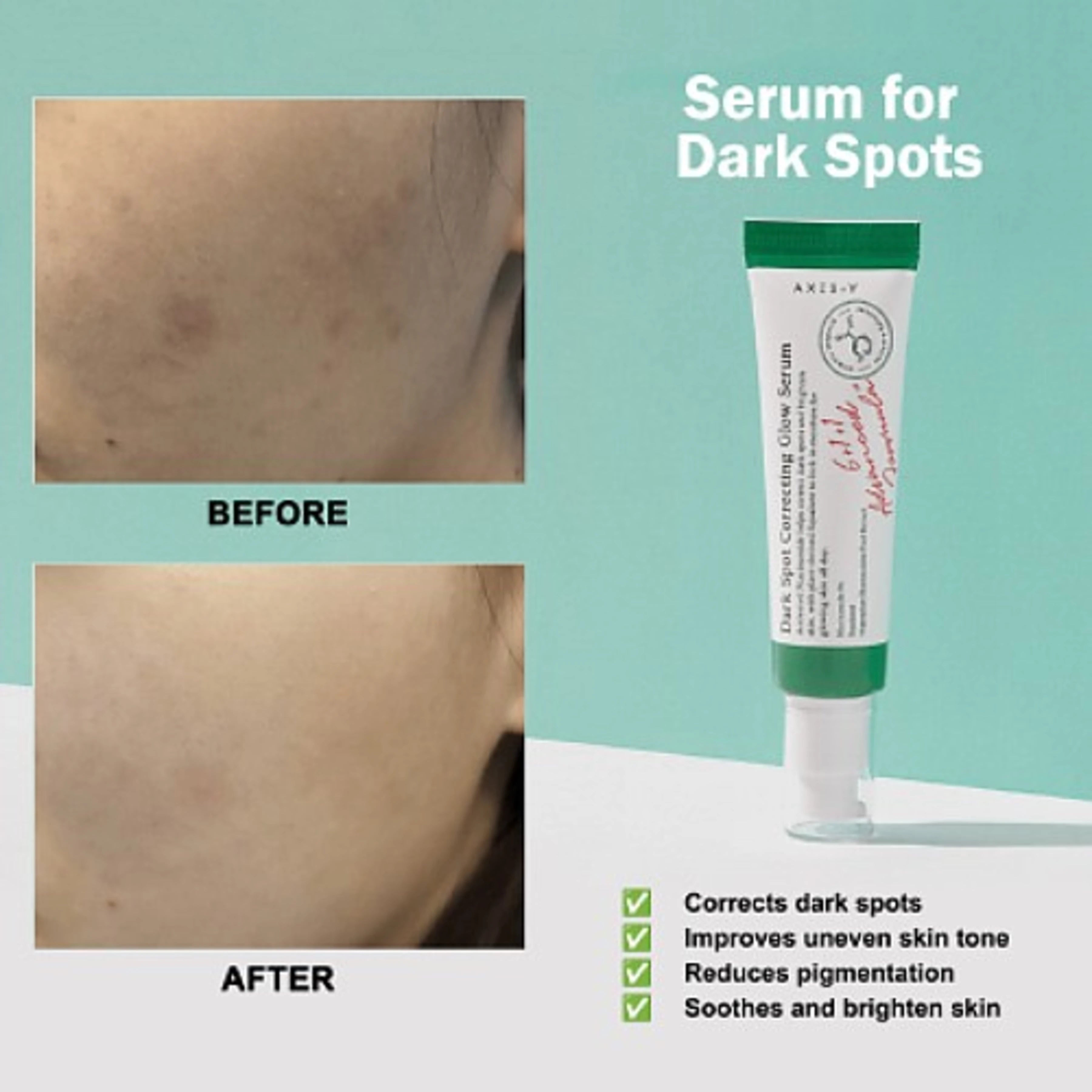 Axis-Y Dark spot correcting Glow Serum 