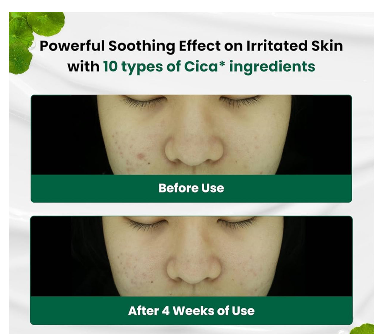 Dr.G Red Blemish Clear Soothing Korean Moisturizer Face Cream