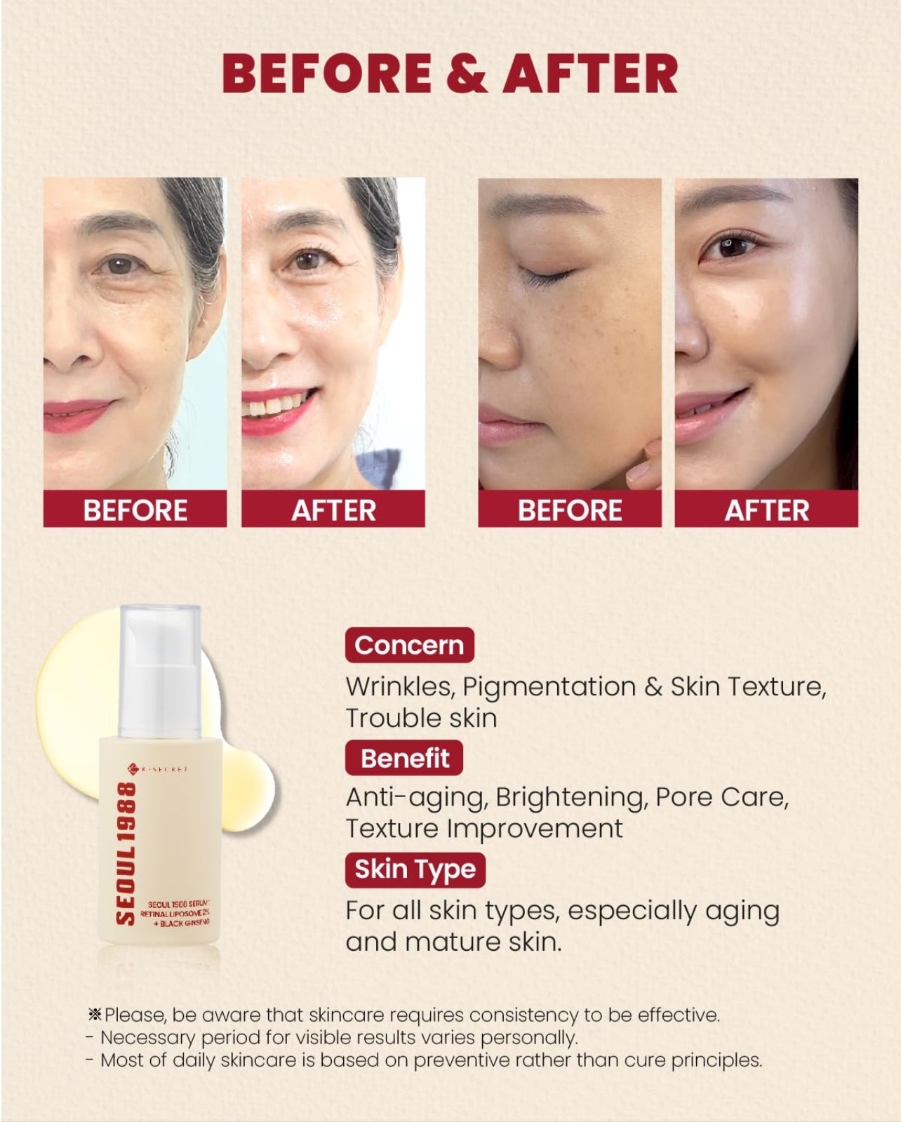 SEOUL 1988 SERUM:
RETINAL LIPOSOME 1%
+ fermented rice