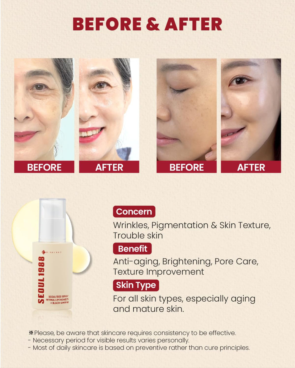 SEOUL 1988 SERUM:
RETINAL LIPOSOME 1%
+ fermented rice