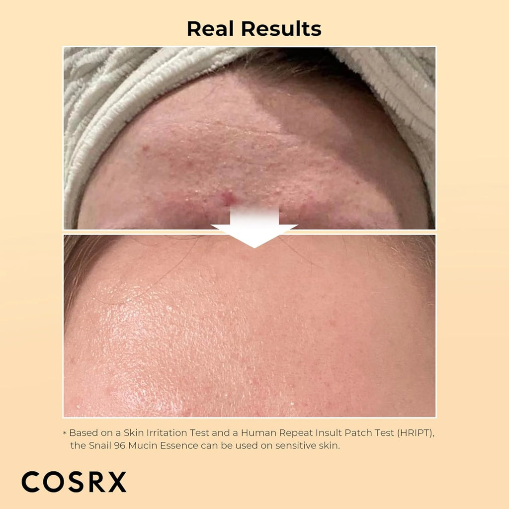 COSRX Advanced Snail 96 Mucin Power Essence 100 mL