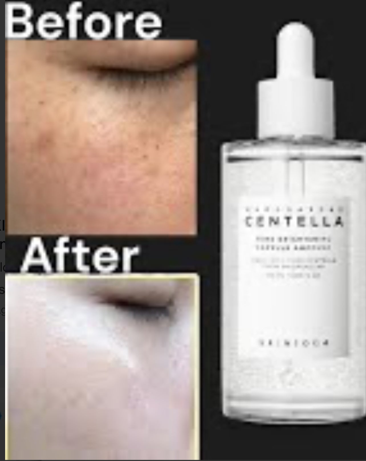 1004 Madagascar Centella Brightening Capsule Ampoule
