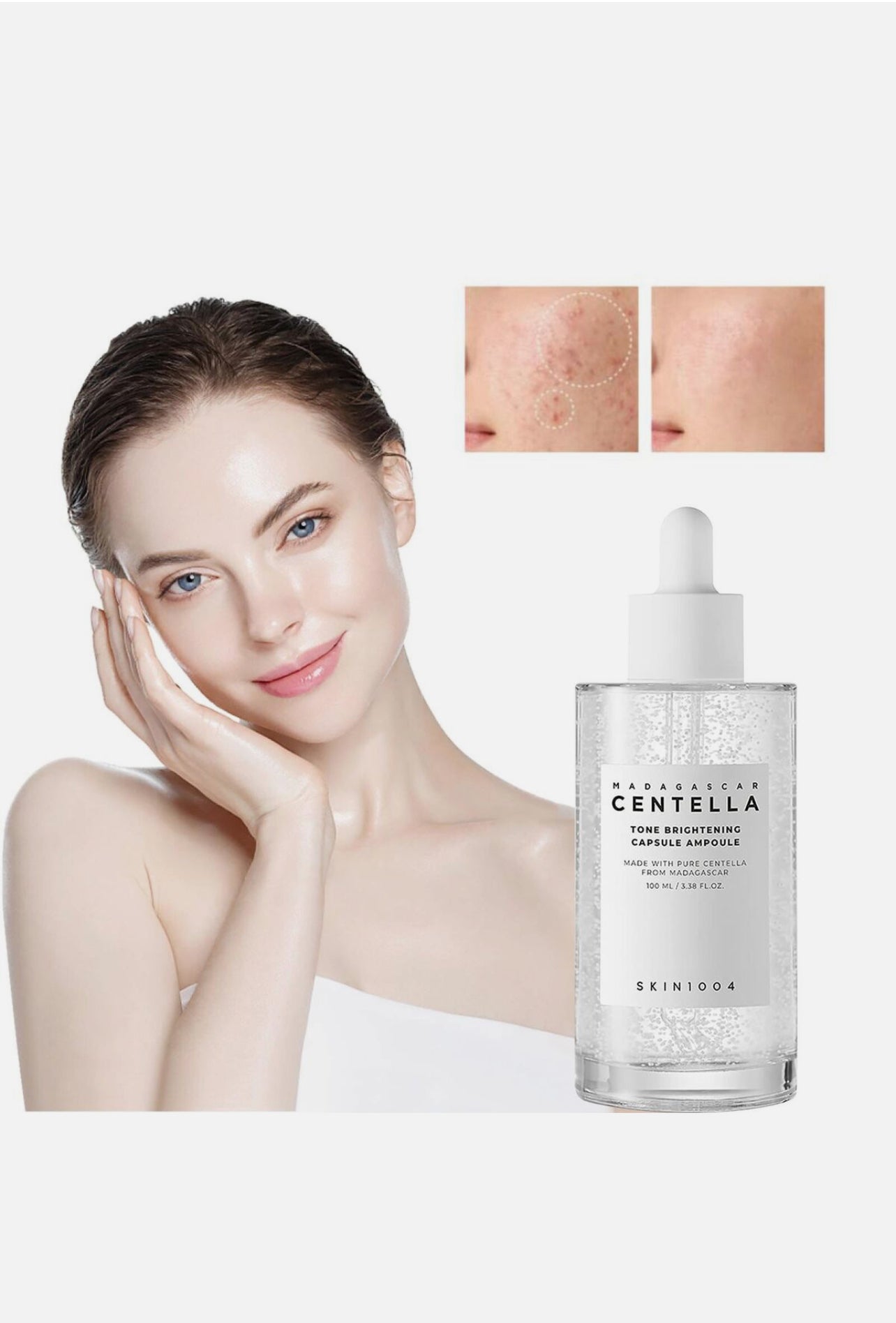 1004 Madagascar Centella Brightening Capsule Ampoule