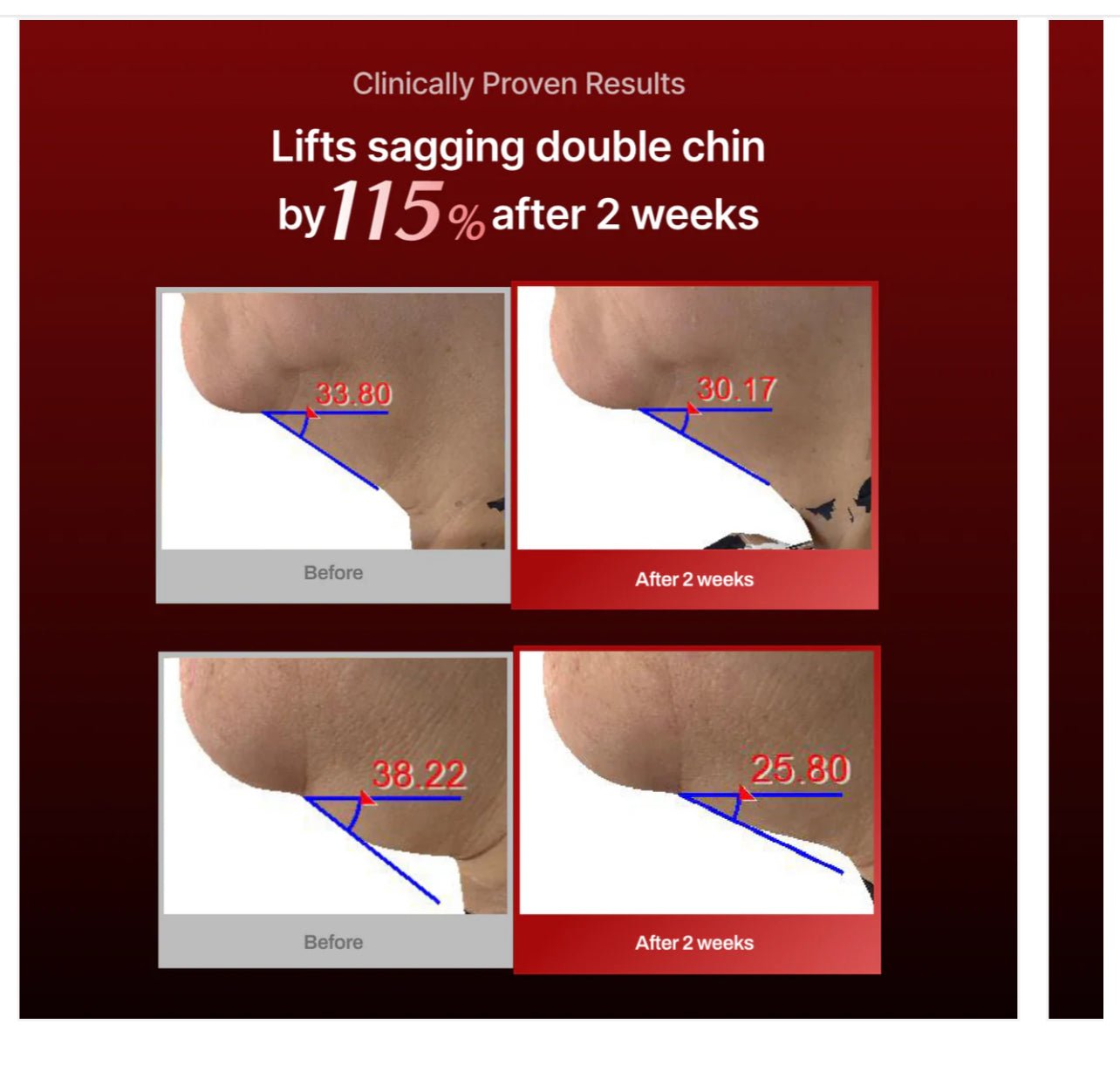 Meditherapy Wrinkle Neck mask