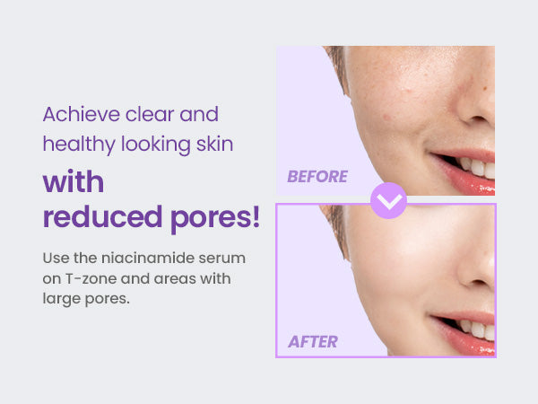 TIRTIR Niacinamide 20% Serum 30ml