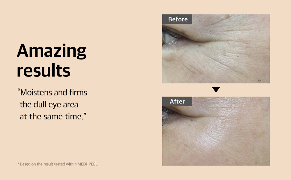 MEDIPEEL Mezzo Filla Eye Serum