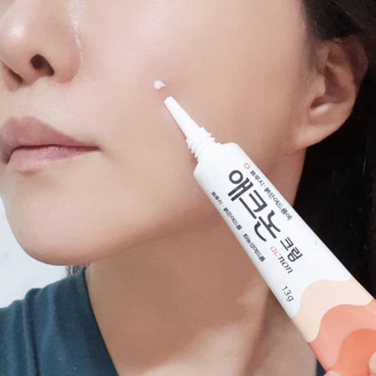 acnon Cream Scar Treat, Surgery & Acne Scars