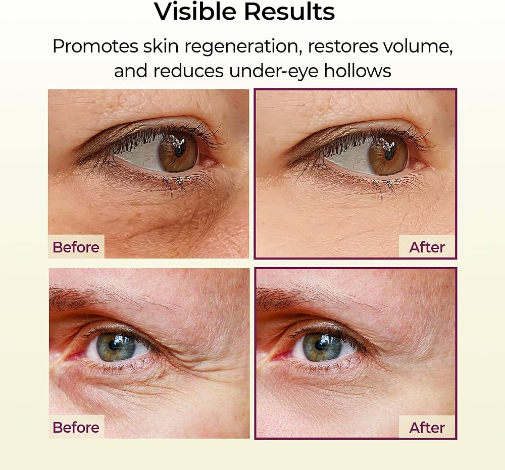 Dr. Melaxin volume eye balm