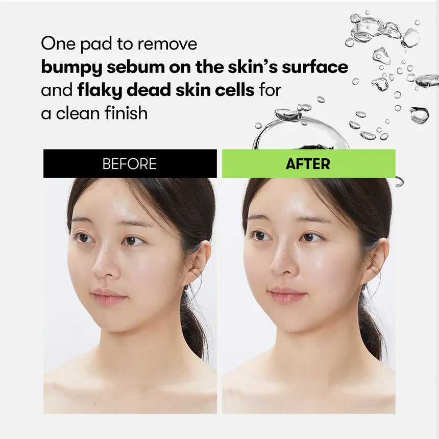 VT REEDLE SHOT SYNERGY SPARKLING TONER PAD
