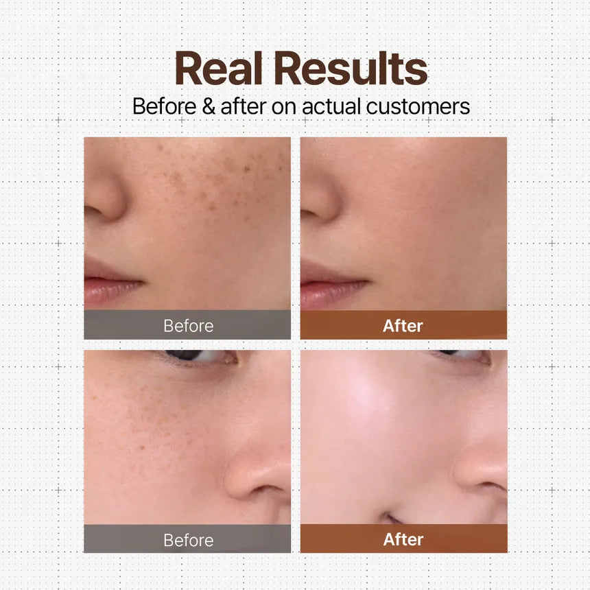 Melatinol Cloud Cream